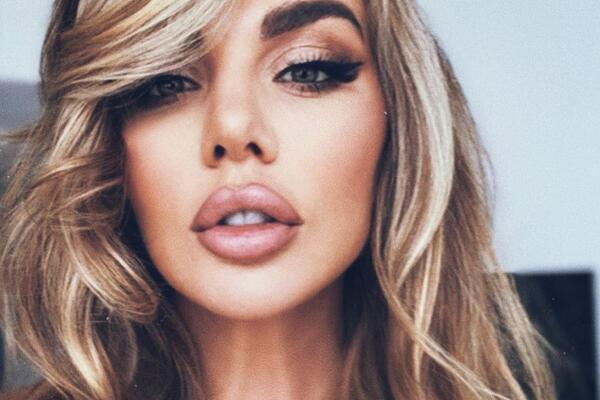 Похудевшая Седокова показала себя после преображения