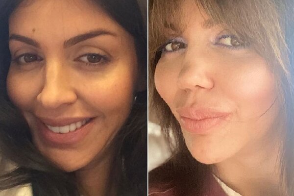 Экс-жена Аршавина изуродовала себя пластикой