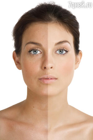 Изменение кожи лица в 30 лет