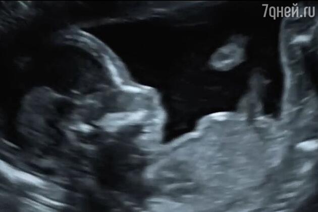 Кадр из клипа «Таю»