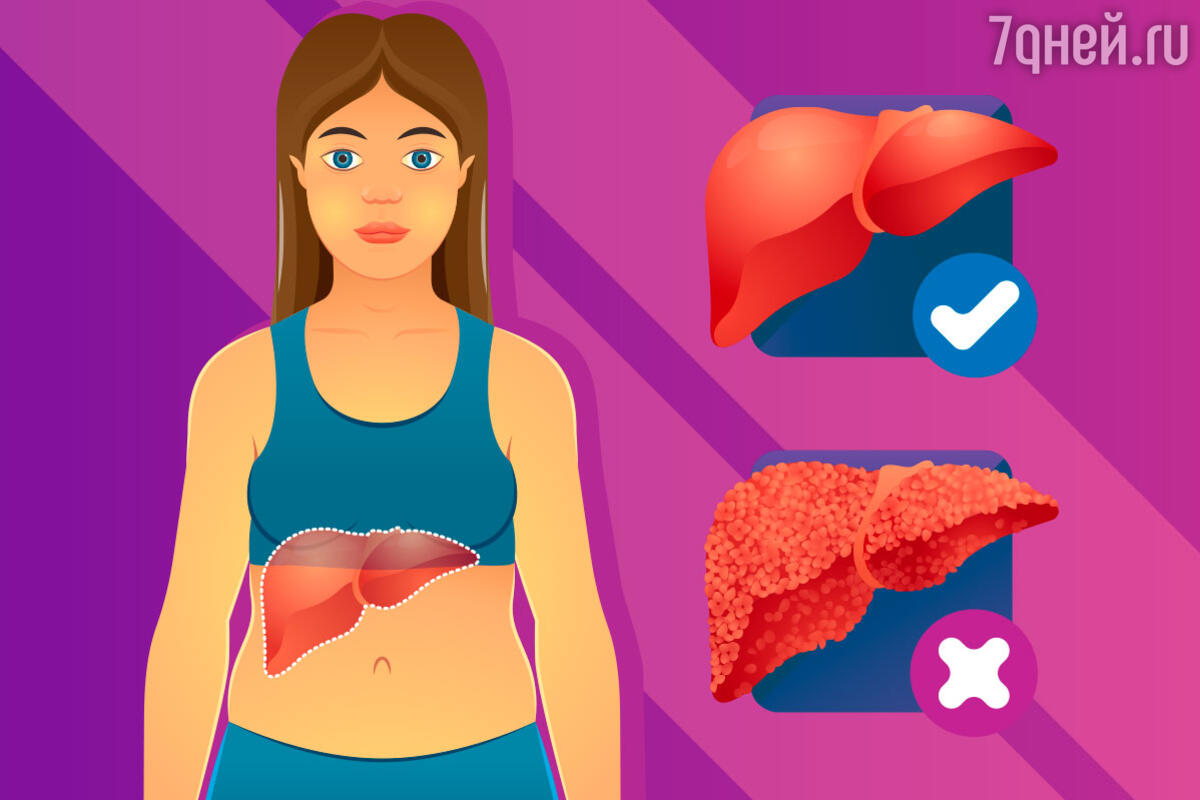От A до D: что нужно знать о гепатите, симптомах и лечении - 7Дней.ру