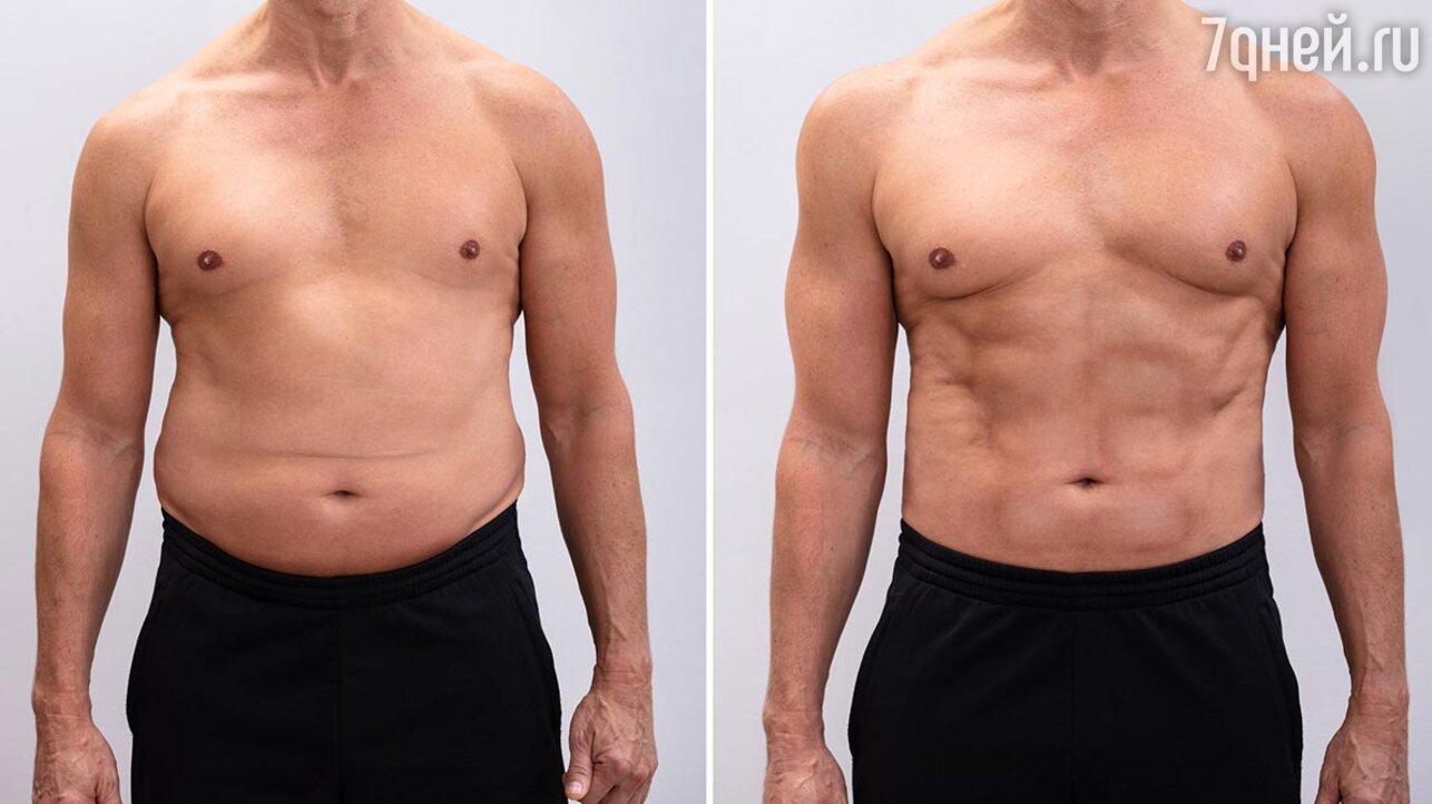 удаления жира с груди у мужчин фото 105