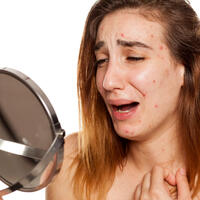 Нервные высыпания: как кожа предупреждает о проблемах с психикой 