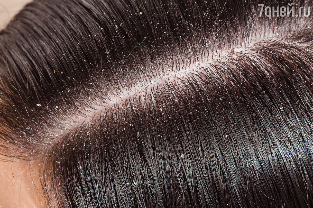Система восстановления волос OLAPLEX: что, как и зачем