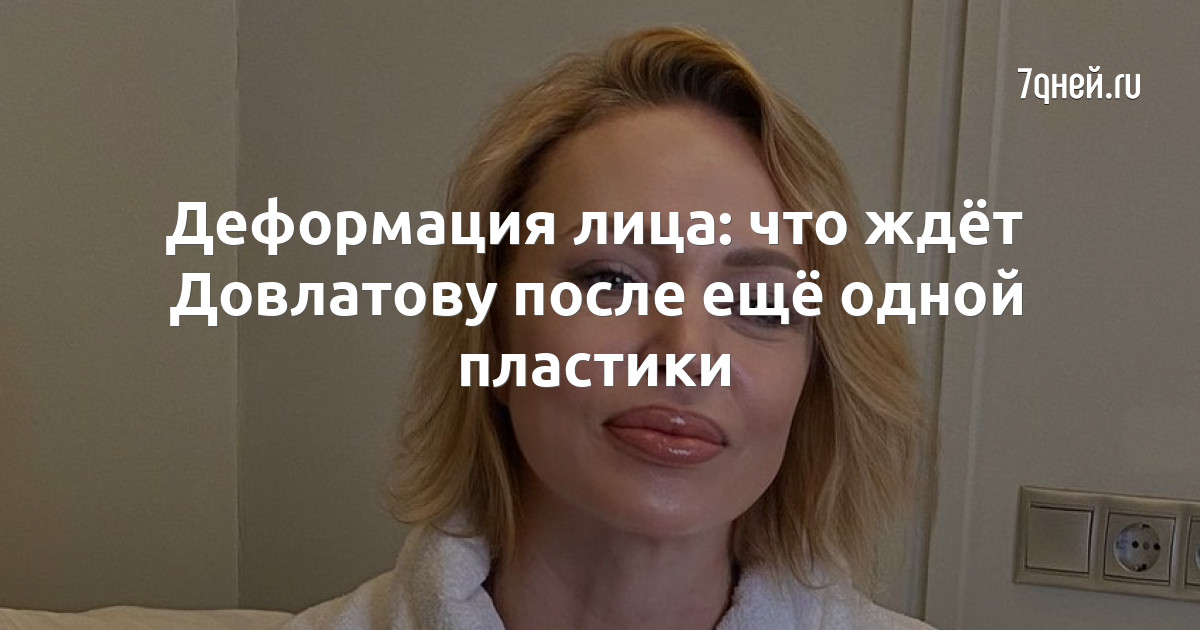 Довлатова до и после пластики Деформация лица: что ждёт Довлатову после ещё одной пластики - 7Дней.ру