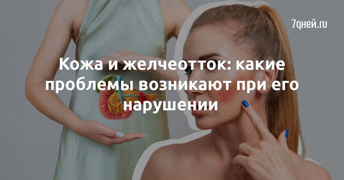 Желчнокаменная болезнь анатомия. Улучшение желчеоттока. Жёлчный пузырь массировать. Плохой желчеотток симптомы. Как улучшить желчеотток.