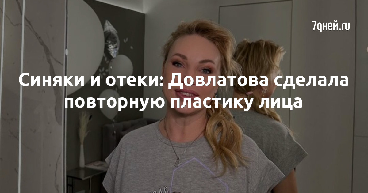 Алла Довлатова Фото До И После