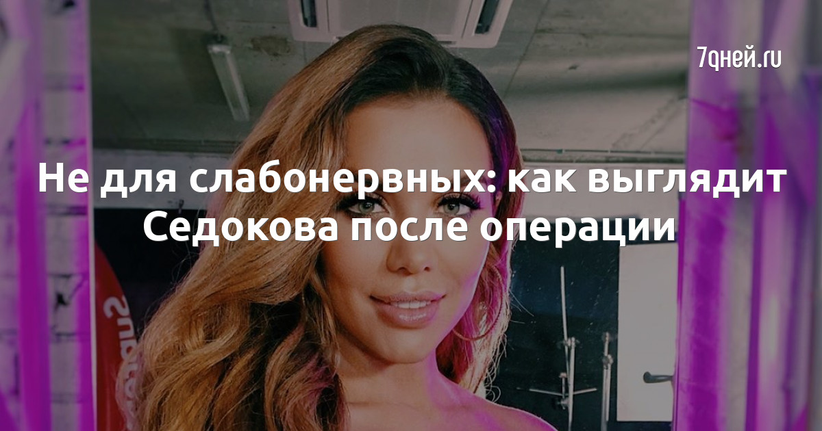 Анна седокова после операции фото