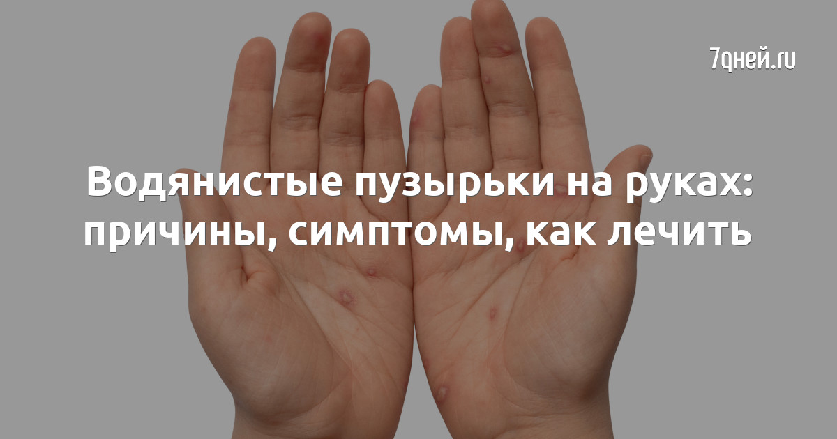 Водянистые пузырьки на пальцах рук: причина появления
